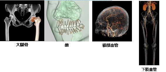 CT撮影写真2