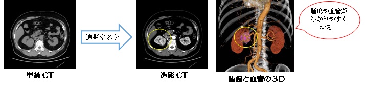 CT撮影写真3