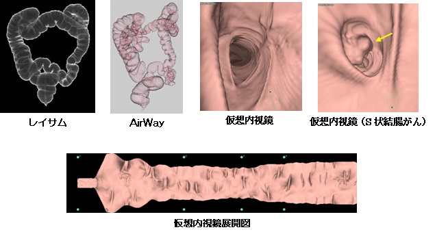 CT撮影写真4