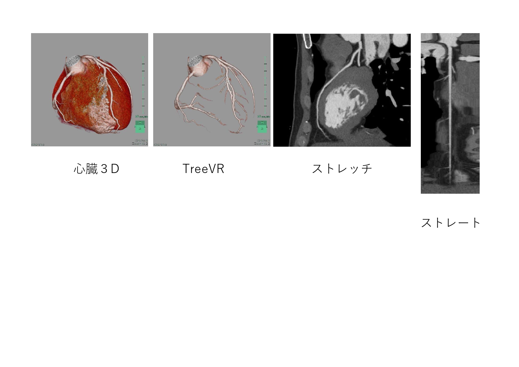 CT撮影写真5