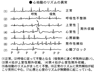 心拍数異常