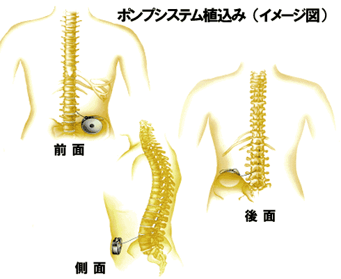 ドイツ製の25度の内視鏡、長径165mm、外径5.9mm